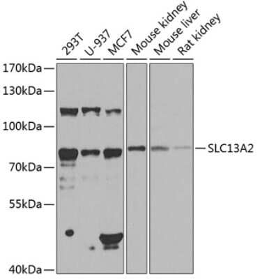 Western Blot: SLC13A2 Antibody [NBP2-94680] - Western blot analysis of extracts of various cell lines, using SLC13A2 antibody (NBP2-94680) at 1:1000 dilution. Secondary antibody: HRP Goat Anti-Rabbit IgG (H+L) at 1:10000 dilution. Lysates/proteins: 25ug per lane. Blocking buffer: 3% nonfat dry milk in TBST. Detection: ECL Enhanced Kit. Exposure time: 10s.